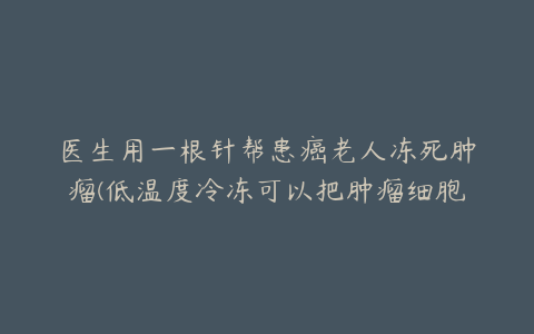 医生用一根针帮患癌老人冻死肿瘤(低温度冷冻可以把肿瘤细胞冻死，已大量用于临床)